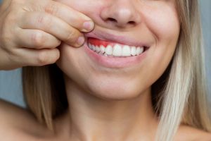 La importancia de la periodoncia para una sonrisa sana